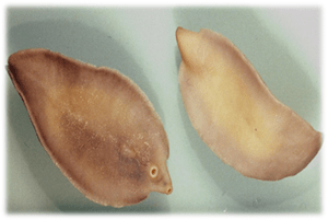 Fasciolose
